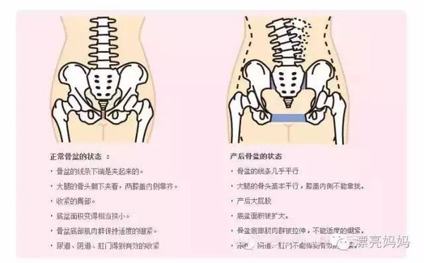骨盆修复，<a href=/news.html?type=0&tag=5dafb87465674de5b1a8c9560cccf09f target=_blank class=infotextkey>漂亮<a href=/news.html?type=0&tag=e810fe1f899a4a06ac17a59b27149051 target=_blank class=infotextkey>妈妈</a></a>来拯救你的大PP！！