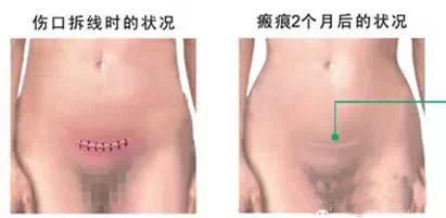 剖腹产<a href=/news.html?type=0&tag=a0135461215b4c3d80bf2c92d7584ff4 target=_blank class=infotextkey><a href=/news.html?type=0&tag=a0135461215b4c3d80bf2c92d7584ff4 target=_blank class=infotextkey><a href=/news.html?type=0&tag=a0135461215b4c3d80bf2c92d7584ff4 target=_blank class=infotextkey><a href=/news.html?type=0&tag=a0135461215b4c3d80bf2c92d7584ff4 target=_blank class=infotextkey><a href=/news.html?type=0&tag=a0135461215b4c3d80bf2c92d7584ff4 target=_blank class=infotextkey><a href=/news.html?type=0&tag=de031511c853414894e6d1d2e82d0470 target=_blank class=infotextkey><a href=/news.html?type=0&tag=de031511c853414894e6d1d2e82d0470 target=_blank class=infotextkey><a href=/news.html?type=0&tag=ccf98c78a50846d2b059ac0ba51d540d target=_blank class=infotextkey><a href=/news.html?type=0&tag=ccf98c78a50846d2b059ac0ba51d540d target=_blank class=infotextkey><a href=/news.html?type=0&tag=ccf98c78a50846d2b059ac0ba51d540d target=_blank class=infotextkey><a href=/news.html?type=0&tag=a0135461215b4c3d80bf2c92d7584ff4 target=_blank class=infotextkey><a href=/news.html?type=0&tag=a0135461215b4c3d80bf2c92d7584ff4 target=_blank class=infotextkey><a href=/news.html?type=0&tag=a0135461215b4c3d80bf2c92d7584ff4 target=_blank class=infotextkey><a href=/news.html?type=0&tag=a0135461215b4c3d80bf2c92d7584ff4 target=_blank class=infotextkey><a href=/news.html?type=0&tag=a0135461215b4c3d80bf2c92d7584ff4 target=_blank class=infotextkey><a href=/news.html?type=0&tag=de031511c853414894e6d1d2e82d0470 target=_blank class=infotextkey><a href=/news.html?type=0&tag=a0135461215b4c3d80bf2c92d7584ff4 target=_blank class=infotextkey><a href=/news.html?type=0&tag=a0135461215b4c3d80bf2c92d7584ff4 target=_blank class=infotextkey><a href=/news.html?type=0&tag=ccf98c78a50846d2b059ac0ba51d540d target=_blank class=infotextkey><a href=/news.html?type=0&tag=a0135461215b4c3d80bf2c92d7584ff4 target=_blank class=infotextkey><a href=/news.html?type=0&tag=a0135461215b4c3d80bf2c92d7584ff4 target=_blank class=infotextkey><a href=/news.html?type=0&tag=a0135461215b4c3d80bf2c92d7584ff4 target=_blank class=infotextkey><a href=/news.html?type=0&tag=a0135461215b4c3d80bf2c92d7584ff4 target=_blank class=infotextkey><a href=/news.html?type=0&tag=a0135461215b4c3d80bf2c92d7584ff4 target=_blank class=infotextkey><a href=/news.html?type=0&tag=a0135461215b4c3d80bf2c92d7584ff4 target=_blank class=infotextkey><a href=/news.html?type=0&tag=a0135461215b4c3d80bf2c92d7584ff4 target=_blank class=infotextkey><a href=/news.html?type=0&tag=a0135461215b4c3d80bf2c92d7584ff4 target=_blank class=infotextkey><a href=/news.html?type=0&tag=a0135461215b4c3d80bf2c92d7584ff4 target=_blank class=infotextkey><a href=/news.html?type=0&tag=a0135461215b4c3d80bf2c92d7584ff4 target=_blank class=infotextkey><a href=/news.html?type=0&tag=a0135461215b4c3d80bf2c92d7584ff4 target=_blank class=infotextkey><a href=/news.html?type=0&tag=a0135461215b4c3d80bf2c92d7584ff4 target=_blank class=infotextkey><a href=/news.html?type=0&tag=a0135461215b4c3d80bf2c92d7584ff4 target=_blank class=infotextkey><a href=/news.html?type=0&tag=a0135461215b4c3d80bf2c92d7584ff4 target=_blank class=infotextkey><a href=/news.html?type=0&tag=a0135461215b4c3d80bf2c92d7584ff4 target=_blank class=infotextkey><a href=/news.html?type=0&tag=a0135461215b4c3d80bf2c92d7584ff4 target=_blank class=infotextkey><a href=/news.html?type=0&tag=a0135461215b4c3d80bf2c92d7584ff4 target=_blank class=infotextkey><a href=/news.html?type=0&tag=a0135461215b4c3d80bf2c92d7584ff4 target=_blank class=infotextkey><a href=/news.html?type=0&tag=a0135461215b4c3d80bf2c92d7584ff4 target=_blank class=infotextkey><a href=/news.html?type=0&tag=a0135461215b4c3d80bf2c92d7584ff4 target=_blank class=infotextkey><a href=/news.html?type=0&tag=a0135461215b4c3d80bf2c92d7584ff4 target=_blank class=infotextkey><a href=/news.html?type=0&tag=a0135461215b4c3d80bf2c92d7584ff4 target=_blank class=infotextkey><a href=/news.html?type=0&tag=a0135461215b4c3d80bf2c92d7584ff4 target=_blank class=infotextkey><a href=/news.html?type=0&tag=a0135461215b4c3d80bf2c92d7584ff4 target=_blank class=infotextkey><a href=/news.html?type=0&tag=a0135461215b4c3d80bf2c92d7584ff4 target=_blank class=infotextkey><a href=/news.html?type=0&tag=a0135461215b4c3d80bf2c92d7584ff4 target=_blank class=infotextkey><a href=/news.html?type=0&tag=a0135461215b4c3d80bf2c92d7584ff4 target=_blank class=infotextkey><a href=/news.html?type=0&tag=a0135461215b4c3d80bf2c92d7584ff4 target=_blank class=infotextkey><a href=/news.html?type=0&tag=a0135461215b4c3d80bf2c92d7584ff4 target=_blank class=infotextkey><a href=/news.html?type=0&tag=a0135461215b4c3d80bf2c92d7584ff4 target=_blank class=infotextkey><a href=/news.html?type=0&tag=a0135461215b4c3d80bf2c92d7584ff4 target=_blank class=infotextkey><a href=/news.html?type=0&tag=a0135461215b4c3d80bf2c92d7584ff4 target=_blank class=infotextkey><a href=/news.html?type=0&tag=a0135461215b4c3d80bf2c92d7584ff4 target=_blank class=infotextkey><a href=/news.html?type=0&tag=a0135461215b4c3d80bf2c92d7584ff4 target=_blank class=infotextkey><a href=/news.html?type=0&tag=a0135461215b4c3d80bf2c92d7584ff4 target=_blank class=infotextkey><a href=/news.html?type=0&tag=a0135461215b4c3d80bf2c92d7584ff4 target=_blank class=infotextkey><a href=/news.html?type=0&tag=a0135461215b4c3d80bf2c92d7584ff4 target=_blank class=infotextkey><a href=/news.html?type=0&tag=a0135461215b4c3d80bf2c92d7584ff4 target=_blank class=infotextkey><a href=/news.html?type=0&tag=a0135461215b4c3d80bf2c92d7584ff4 target=_blank class=infotextkey><a href=/news.html?type=0&tag=a0135461215b4c3d80bf2c92d7584ff4 target=_blank class=infotextkey><a href=/news.html?type=0&tag=a0135461215b4c3d80bf2c92d7584ff4 target=_blank class=infotextkey><a href=/news.html?type=0&tag=a0135461215b4c3d80bf2c92d7584ff4 target=_blank class=infotextkey><a href=/news.html?type=0&tag=a0135461215b4c3d80bf2c92d7584ff4 target=_blank class=infotextkey><a href=/news.html?type=0&tag=a0135461215b4c3d80bf2c92d7584ff4 target=_blank class=infotextkey><a href=/news.html?type=0&tag=a0135461215b4c3d80bf2c92d7584ff4 target=_blank class=infotextkey><a href=/news.html?type=0&tag=a0135461215b4c3d80bf2c92d7584ff4 target=_blank class=infotextkey><a href=/news.html?type=0&tag=a0135461215b4c3d80bf2c92d7584ff4 target=_blank class=infotextkey><a href=/news.html?type=0&tag=a0135461215b4c3d80bf2c92d7584ff4 target=_blank class=infotextkey><a href=/news.html?type=0&tag=a0135461215b4c3d80bf2c92d7584ff4 target=_blank class=infotextkey><a href=/news.html?type=0&tag=a0135461215b4c3d80bf2c92d7584ff4 target=_blank class=infotextkey><a href=/news.html?type=0&tag=a0135461215b4c3d80bf2c92d7584ff4 target=_blank class=infotextkey><a href=/news.html?type=0&tag=a0135461215b4c3d80bf2c92d7584ff4 target=_blank class=infotextkey><a href=/news.html?type=0&tag=a0135461215b4c3d80bf2c92d7584ff4 target=_blank class=infotextkey><a href=/news.html?type=0&tag=a0135461215b4c3d80bf2c92d7584ff4 target=_blank class=infotextkey><a href=/news.html?type=0&tag=a0135461215b4c3d80bf2c92d7584ff4 target=_blank class=infotextkey><a href=/news.html?type=0&tag=ccf98c78a50846d2b059ac0ba51d540d target=_blank class=infotextkey><a href=/news.html?type=0&tag=ccf98c78a50846d2b059ac0ba51d540d target=_blank class=infotextkey><a href=/news.html?type=0&tag=ccf98c78a50846d2b059ac0ba51d540d target=_blank class=infotextkey><a href=/news.html?type=0&tag=a0135461215b4c3d80bf2c92d7584ff4 target=_blank class=infotextkey><a href=/news.html?type=0&tag=a0135461215b4c3d80bf2c92d7584ff4 target=_blank class=infotextkey><a href=/news.html?type=0&tag=a0135461215b4c3d80bf2c92d7584ff4 target=_blank class=infotextkey><a href=/news.html?type=0&tag=a0135461215b4c3d80bf2c92d7584ff4 target=_blank class=infotextkey><a href=/news.html?type=0&tag=a0135461215b4c3d80bf2c92d7584ff4 target=_blank class=infotextkey><a href=/news.html?type=0&tag=a0135461215b4c3d80bf2c92d7584ff4 target=_blank class=infotextkey><a href=/news.html?type=0&tag=a0135461215b4c3d80bf2c92d7584ff4 target=_blank class=infotextkey><a href=/news.html?type=0&tag=a0135461215b4c3d80bf2c92d7584ff4 target=_blank class=infotextkey><a href=/news.html?type=0&tag=a0135461215b4c3d80bf2c92d7584ff4 target=_blank class=infotextkey><a href=/news.html?type=0&tag=a0135461215b4c3d80bf2c92d7584ff4 target=_blank class=infotextkey><a href=/news.html?type=0&tag=a0135461215b4c3d80bf2c92d7584ff4 target=_blank class=infotextkey><a href=/news.html?type=0&tag=a0135461215b4c3d80bf2c92d7584ff4 target=_blank class=infotextkey><a href=/news.html?type=0&tag=a0135461215b4c3d80bf2c92d7584ff4 target=_blank class=infotextkey><a href=/news.html?type=0&tag=a0135461215b4c3d80bf2c92d7584ff4 target=_blank class=infotextkey><a href=/news.html?type=0&tag=a0135461215b4c3d80bf2c92d7584ff4 target=_blank class=infotextkey><a href=/news.html?type=0&tag=a0135461215b4c3d80bf2c92d7584ff4 target=_blank class=infotextkey><a href=/news.html?type=0&tag=a0135461215b4c3d80bf2c92d7584ff4 target=_blank class=infotextkey><a href=/news.html?type=0&tag=a0135461215b4c3d80bf2c92d7584ff4 target=_blank class=infotextkey><a href=/news.html?type=0&tag=a0135461215b4c3d80bf2c92d7584ff4 target=_blank class=infotextkey><a href=/news.html?type=0&tag=a0135461215b4c3d80bf2c92d7584ff4 target=_blank class=infotextkey><a href=/news.html?type=0&tag=a0135461215b4c3d80bf2c92d7584ff4 target=_blank class=infotextkey><a href=/news.html?type=0&tag=a0135461215b4c3d80bf2c92d7584ff4 target=_blank class=infotextkey><a href=/news.html?type=0&tag=a0135461215b4c3d80bf2c92d7584ff4 target=_blank class=infotextkey><a href=/news.html?type=0&tag=a0135461215b4c3d80bf2c92d7584ff4 target=_blank class=infotextkey><a href=/news.html?type=0&tag=a0135461215b4c3d80bf2c92d7584ff4 target=_blank class=infotextkey><a href=/news.html?type=0&tag=a0135461215b4c3d80bf2c92d7584ff4 target=_blank class=infotextkey><a href=/news.html?type=0&tag=a0135461215b4c3d80bf2c92d7584ff4 target=_blank class=infotextkey><a href=/news.html?type=0&tag=a0135461215b4c3d80bf2c92d7584ff4 target=_blank class=infotextkey><a href=/news.html?type=0&tag=a0135461215b4c3d80bf2c92d7584ff4 target=_blank class=infotextkey><a href=/news.html?type=0&tag=ccf98c78a50846d2b059ac0ba51d540d target=_blank class=infotextkey><a href=/news.html?type=0&tag=ccf98c78a50846d2b059ac0ba51d540d target=_blank class=infotextkey><a href=/news.html?type=0&tag=a0135461215b4c3d80bf2c92d7584ff4 target=_blank class=infotextkey><a href=/news.html?type=0&tag=a0135461215b4c3d80bf2c92d7584ff4 target=_blank class=infotextkey><a href=/news.html?type=0&tag=a0135461215b4c3d80bf2c92d7584ff4 target=_blank class=infotextkey><a href=/news.html?type=0&tag=a0135461215b4c3d80bf2c92d7584ff4 target=_blank class=infotextkey><a href=/news.html?type=0&tag=a0135461215b4c3d80bf2c92d7584ff4 target=_blank class=infotextkey><a href=/news.html?type=0&tag=a0135461215b4c3d80bf2c92d7584ff4 target=_blank class=infotextkey><a href=/news.html?type=0&tag=a0135461215b4c3d80bf2c92d7584ff4 target=_blank class=infotextkey><a href=/news.html?type=0&tag=a0135461215b4c3d80bf2c92d7584ff4 target=_blank class=infotextkey><a href=/news.html?type=0&tag=a0135461215b4c3d80bf2c92d7584ff4 target=_blank class=infotextkey><a href=/news.html?type=0&tag=a0135461215b4c3d80bf2c92d7584ff4 target=_blank class=infotextkey><a href=/news.html?type=0&tag=a0135461215b4c3d80bf2c92d7584ff4 target=_blank class=infotextkey><a href=/news.html?type=0&tag=a0135461215b4c3d80bf2c92d7584ff4 target=_blank class=infotextkey><a href=/news.html?type=0&tag=a0135461215b4c3d80bf2c92d7584ff4 target=_blank class=infotextkey><a href=/news.html?type=0&tag=a0135461215b4c3d80bf2c92d7584ff4 target=_blank class=infotextkey><a href=/news.html?type=0&tag=a0135461215b4c3d80bf2c92d7584ff4 target=_blank class=infotextkey><a href=/news.html?type=0&tag=a0135461215b4c3d80bf2c92d7584ff4 target=_blank class=infotextkey><a href=/news.html?type=0&tag=ccf98c78a50846d2b059ac0ba51d540d target=_blank class=infotextkey><a href=/news.html?type=0&tag=a0135461215b4c3d80bf2c92d7584ff4 target=_blank class=infotextkey><a href=/news.html?type=0&tag=a0135461215b4c3d80bf2c92d7584ff4 target=_blank class=infotextkey><a href=/news.html?type=0&tag=a0135461215b4c3d80bf2c92d7584ff4 target=_blank class=infotextkey><a href=/news.html?type=0&tag=a0135461215b4c3d80bf2c92d7584ff4 target=_blank class=infotextkey><a href=/news.html?type=0&tag=a0135461215b4c3d80bf2c92d7584ff4 target=_blank class=infotextkey><a href=/news.html?type=0&tag=a0135461215b4c3d80bf2c92d7584ff4 target=_blank class=infotextkey><a href=/news.html?type=0&tag=a0135461215b4c3d80bf2c92d7584ff4 target=_blank class=infotextkey><a href=/news.html?type=0&tag=a0135461215b4c3d80bf2c92d7584ff4 target=_blank class=infotextkey><a href=/news.html?type=0&tag=a0135461215b4c3d80bf2c92d7584ff4 target=_blank class=infotextkey><a href=/news.html?type=0&tag=a0135461215b4c3d80bf2c92d7584ff4 target=_blank class=infotextkey><a href=/news.html?type=0&tag=a0135461215b4c3d80bf2c92d7584ff4 target=_blank class=infotextkey><a href=/news.html?type=0&tag=a0135461215b4c3d80bf2c92d7584ff4 target=_blank class=infotextkey><a href=/news.html?type=0&tag=a0135461215b4c3d80bf2c92d7584ff4 target=_blank class=infotextkey><a href=/news.html?type=0&tag=a0135461215b4c3d80bf2c92d7584ff4 target=_blank class=infotextkey><a href=/news.html?type=0&tag=a0135461215b4c3d80bf2c92d7584ff4 target=_blank class=infotextkey><a href=/news.html?type=0&tag=a0135461215b4c3d80bf2c92d7584ff4 target=_blank class=infotextkey><a href=/news.html?type=0&tag=a0135461215b4c3d80bf2c92d7584ff4 target=_blank class=infotextkey><a href=/news.html?type=0&tag=a0135461215b4c3d80bf2c92d7584ff4 target=_blank class=infotextkey><a href=/news.html?type=0&tag=a0135461215b4c3d80bf2c92d7584ff4 target=_blank class=infotextkey><a href=/news.html?type=0&tag=a0135461215b4c3d80bf2c92d7584ff4 target=_blank class=infotextkey><a href=/news.html?type=0&tag=a0135461215b4c3d80bf2c92d7584ff4 target=_blank class=infotextkey><a href=/news.html?type=0&tag=a0135461215b4c3d80bf2c92d7584ff4 target=_blank class=infotextkey><a href=/news.html?type=0&tag=a0135461215b4c3d80bf2c92d7584ff4 target=_blank class=infotextkey><a href=/news.html?type=0&tag=a0135461215b4c3d80bf2c92d7584ff4 target=_blank class=infotextkey><a href=/news.html?type=0&tag=a0135461215b4c3d80bf2c92d7584ff4 target=_blank class=infotextkey><a href=/news.html?type=0&tag=a0135461215b4c3d80bf2c92d7584ff4 target=_blank class=infotextkey><a href=/news.html?type=0&tag=a0135461215b4c3d80bf2c92d7584ff4 target=_blank class=infotextkey><a href=/news.html?type=0&tag=a0135461215b4c3d80bf2c92d7584ff4 target=_blank class=infotextkey><a href=/news.html?type=0&tag=a0135461215b4c3d80bf2c92d7584ff4 target=_blank class=infotextkey><a href=/news.html?type=0&tag=a0135461215b4c3d80bf2c92d7584ff4 target=_blank class=infotextkey><a href=/news.html?type=0&tag=a0135461215b4c3d80bf2c92d7584ff4 target=_blank class=infotextkey><a href=/news.html?type=0&tag=a0135461215b4c3d80bf2c92d7584ff4 target=_blank class=infotextkey><a href=/news.html?type=0&tag=a0135461215b4c3d80bf2c92d7584ff4 target=_blank class=infotextkey><a href=/news.html?type=0&tag=a0135461215b4c3d80bf2c92d7584ff4 target=_blank class=infotextkey><a href=/news.html?type=0&tag=a0135461215b4c3d80bf2c92d7584ff4 target=_blank class=infotextkey><a href=/news.html?type=0&tag=a0135461215b4c3d80bf2c92d7584ff4 target=_blank class=infotextkey><a href=/news.html?type=0&tag=a0135461215b4c3d80bf2c92d7584ff4 target=_blank class=infotextkey><a href=/news.html?type=0&tag=a0135461215b4c3d80bf2c92d7584ff4 target=_blank class=infotextkey><a href=/news.html?type=0&tag=a0135461215b4c3d80bf2c92d7584ff4 target=_blank class=infotextkey><a href=/news.html?type=0&tag=a0135461215b4c3d80bf2c92d7584ff4 target=_blank class=infotextkey><a href=/news.html?type=0&tag=a0135461215b4c3d80bf2c92d7584ff4 target=_blank class=infotextkey><a href=/news.html?type=0&tag=a0135461215b4c3d80bf2c92d7584ff4 target=_blank class=infotextkey><a href=/news.html?type=0&tag=a0135461215b4c3d80bf2c92d7584ff4 target=_blank class=infotextkey><a href=/news.html?type=0&tag=a0135461215b4c3d80bf2c92d7584ff4 target=_blank class=infotextkey><a href=/news.html?type=0&tag=a0135461215b4c3d80bf2c92d7584ff4 target=_blank class=infotextkey><a href=/news.html?type=0&tag=a0135461215b4c3d80bf2c92d7584ff4 target=_blank class=infotextkey><a href=/news.html?type=0&tag=a0135461215b4c3d80bf2c92d7584ff4 target=_blank class=infotextkey><a href=/news.html?type=0&tag=a0135461215b4c3d80bf2c92d7584ff4 target=_blank class=infotextkey><a href=/news.html?type=0&tag=a0135461215b4c3d80bf2c92d7584ff4 target=_blank class=infotextkey><a href=/news.html?type=0&tag=ccf98c78a50846d2b059ac0ba51d540d target=_blank class=infotextkey>产后恢复</a></a></a></a></a></a></a></a></a></a></a></a></a></a></a></a></a></a></a></a></a></a></a></a></a></a></a></a></a></a></a></a></a></a></a></a></a></a></a></a></a></a></a></a></a></a></a></a></a></a></a></a></a></a></a></a></a></a></a></a></a></a></a></a></a></a></a></a></a></a></a></a></a></a></a></a></a></a></a></a></a></a></a></a></a></a></a></a></a></a></a></a></a></a></a></a></a></a></a></a></a></a></a></a></a></a></a></a></a></a></a></a></a></a></a></a></a></a></a></a></a></a></a></a></a></a></a></a></a></a></a></a></a></a></a></a></a></a></a></a></a></a></a></a></a></a></a></a></a></a></a></a></a></a></a></a></a></a></a></a></a></a></a></a></a></a></a></a></a></a></a></a></a></a></a>？剖腹产刀口多久恢复？