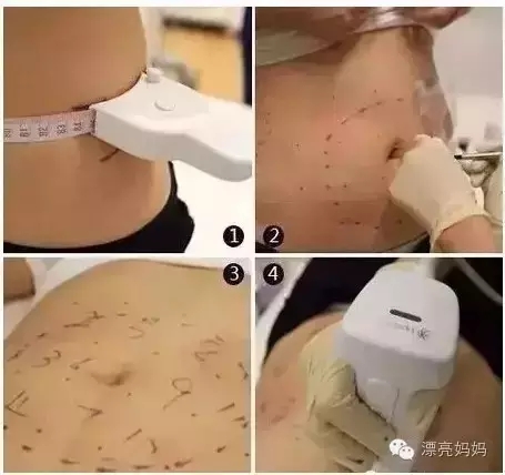 【漂亮妈妈科普篇】有一种瘦叫我是你的热立塑！