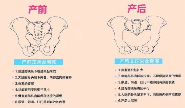 产后恢复要恢复什么呢？产后为什么一定要做产后恢复练习？