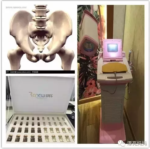 骨盆修复辣么重要，漂亮妈妈不可不知！