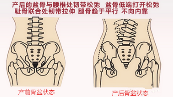 尿失禁、子宫脱垂、阴道松弛，产后遇上这些问题怎么办？ 产后盆底肌如何修复？
