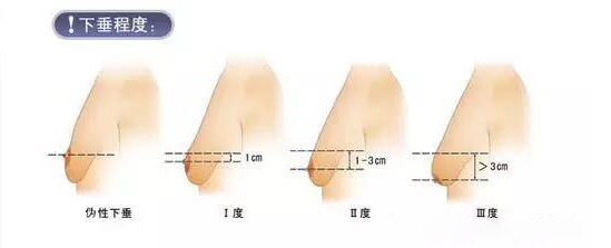 产后乳房松弛下垂原因？产后丰胸<a href=/news.html?type=0&tag=cfe993b1fc7741848627514eeff1b4af target=_blank class=infotextkey><a href=/news.html?type=0&tag=cfe993b1fc7741848627514eeff1b4af target=_blank class=infotextkey><a href=/news.html?type=0&tag=cfe993b1fc7741848627514eeff1b4af target=_blank class=infotextkey><a href=/news.html?type=0&tag=cfe993b1fc7741848627514eeff1b4af target=_blank class=infotextkey><a href=/news.html?type=0&tag=cfe993b1fc7741848627514eeff1b4af target=_blank class=infotextkey><a href=/news.html?type=0&tag=cfe993b1fc7741848627514eeff1b4af target=_blank class=infotextkey><a href=/news.html?type=0&tag=cfe993b1fc7741848627514eeff1b4af target=_blank class=infotextkey>产后胸部护理</a></a></a></a></a></a></a>方法？