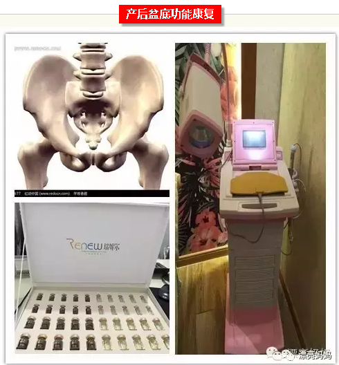 为什么要做产后骨盆修复？与产后盆底功能康复的关系？
