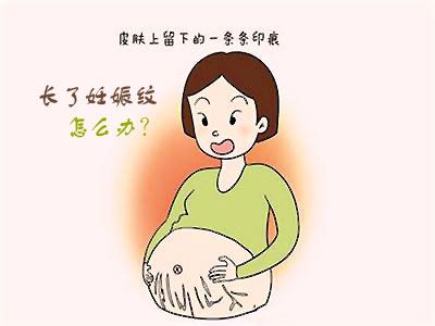 产后去掉妊娠纹的方法？漂亮妈妈产后恢复中心